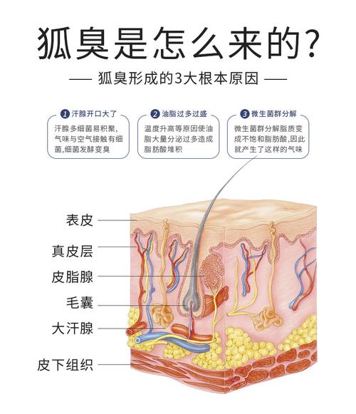 狐臭怎么彻底去除?
