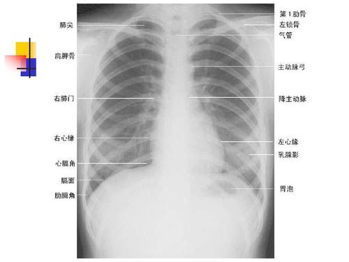 ct片子怎么看?