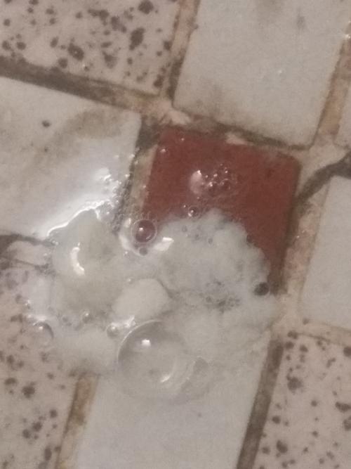 咳白痰是怎么回事?